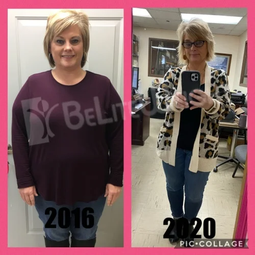 Weight Loss With Gastric Sleeve Surgery Teresa B - 4 Year Update*